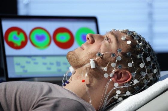 EEG vyšetrenie mozgu je pravdepodobne z najpresnejších metód, pomocou ktorých možno s istotu epilepsiu diagnostikovať